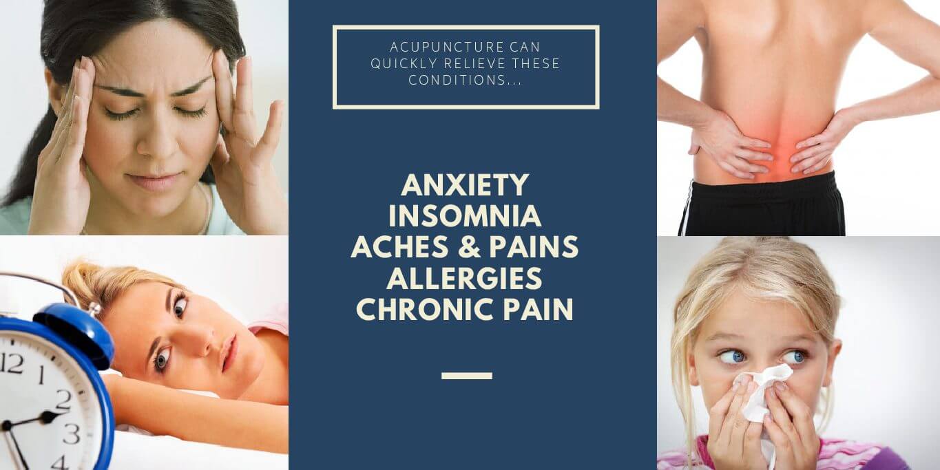 Can Acupuncture Help You?